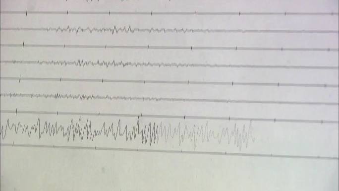 地震检测记录波形图