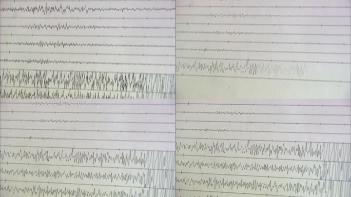 地震检测记录波形图