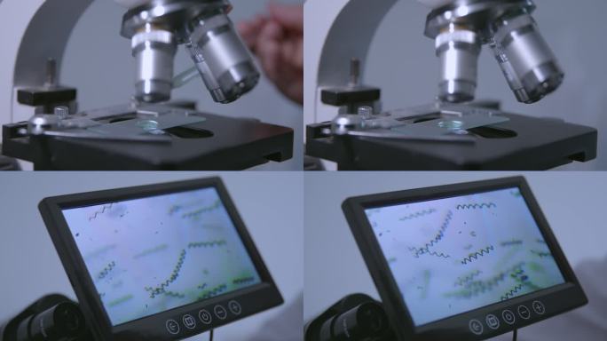 用显微镜观察螺旋藻