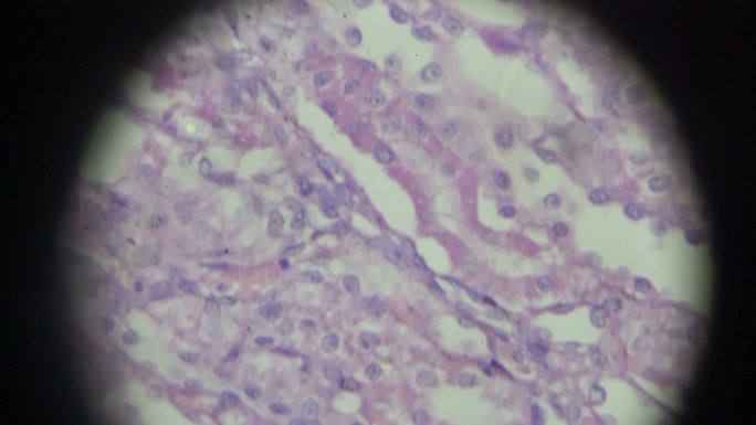 显微镜下肾脏横截面