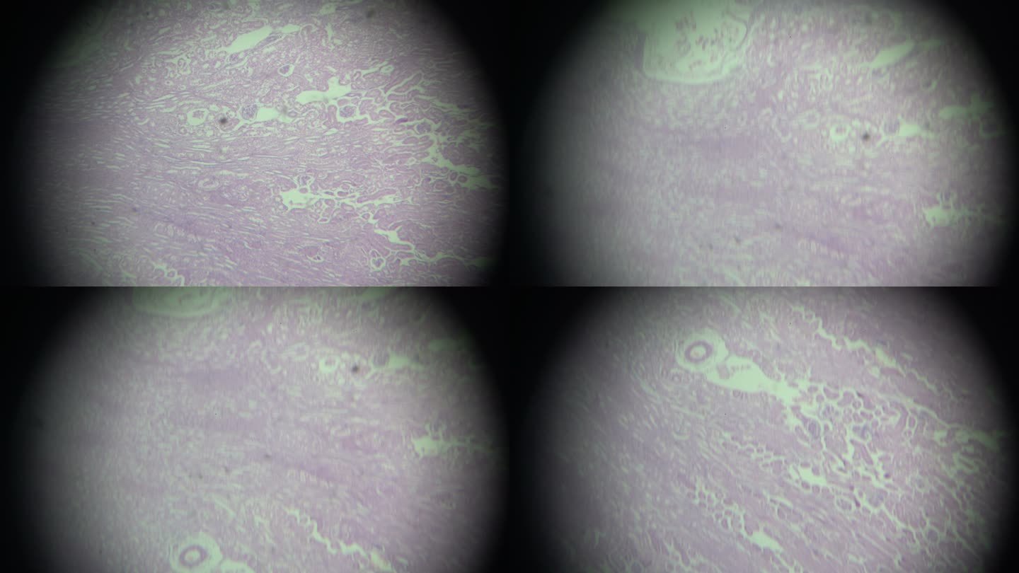显微镜下肾脏横截面