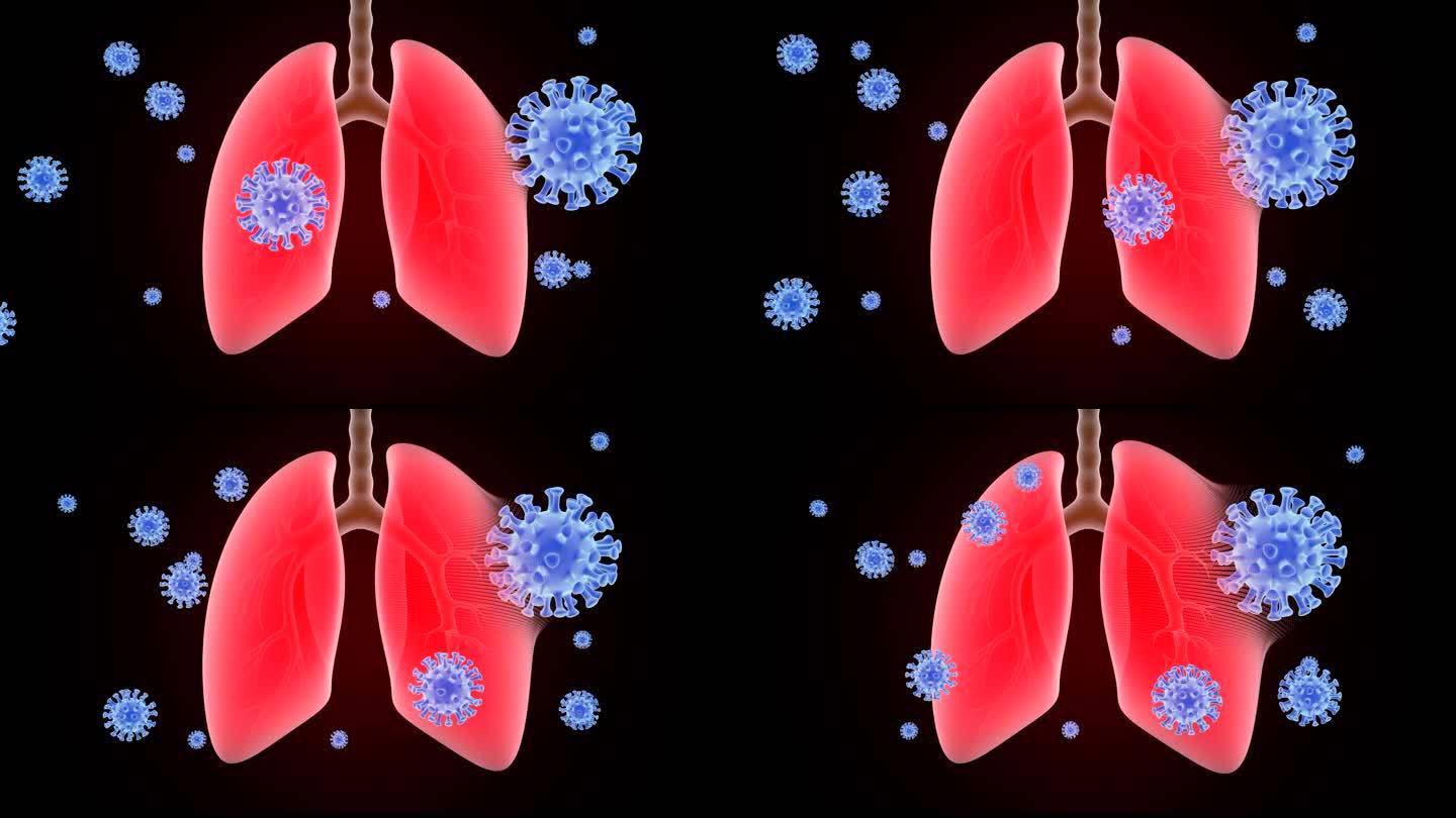 新冠感染肺部动画