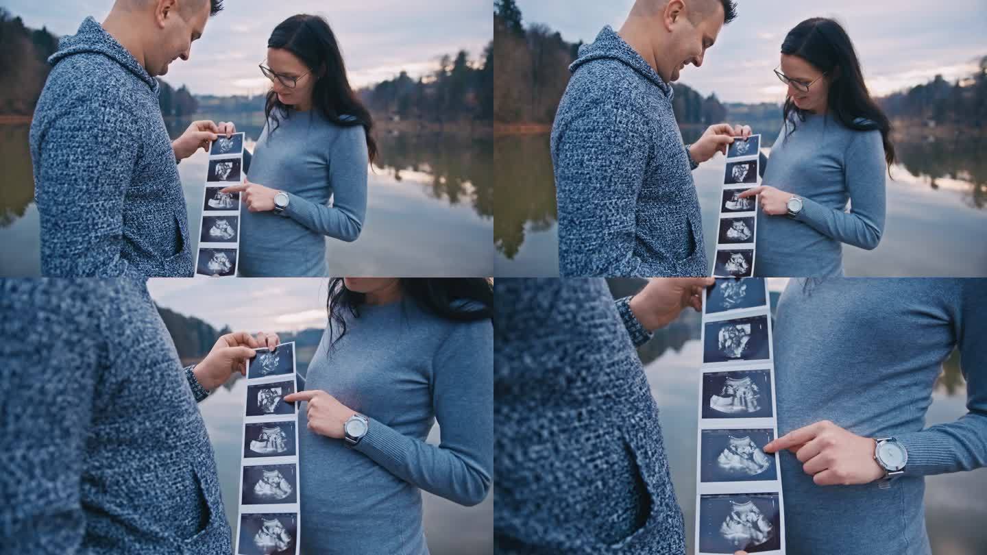 中年夫妇在看婴儿的超声波扫描