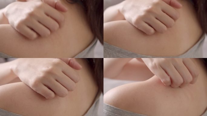 4k分辨率的亚洲女人用手在他发痒的脖子上搔痒。医疗保健和医疗理念。湿疹皮肤