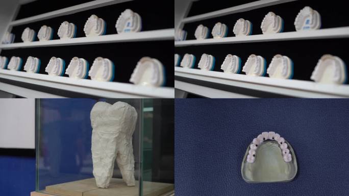 义齿模型 假牙模型 牙齿模型 牙科 牙齿
