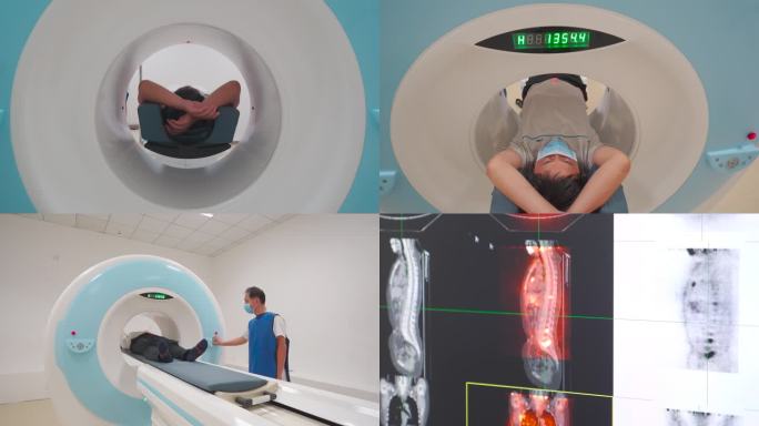 医院DS-CT检测癌症