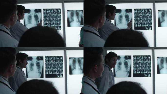 医生团队正在讨论如何用x射线ct扫描片的结果来治疗患者