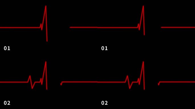 视频素材-心电图01_共3种