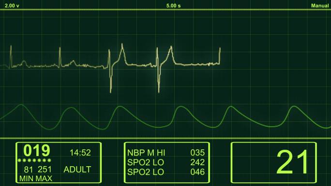 ECG-心电图心脏监视器-HD