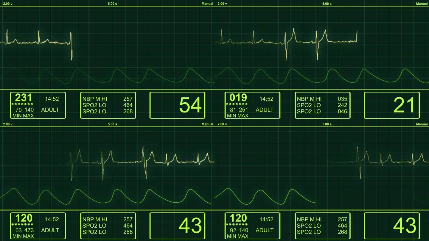 ECG-心电图心脏监视器-HD