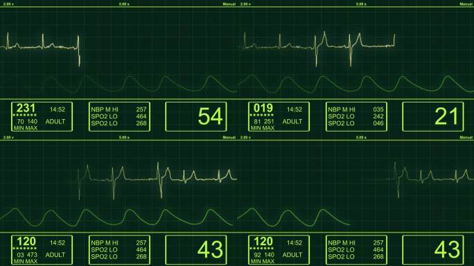 ECG-心电图心脏监视器-HD
