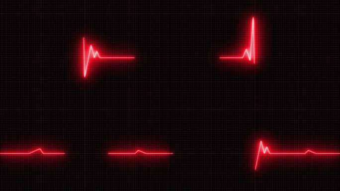 心跳线和EKG ECG 4K可循环