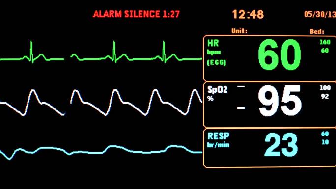 生命体征监测器心电图生命体征医疗设备