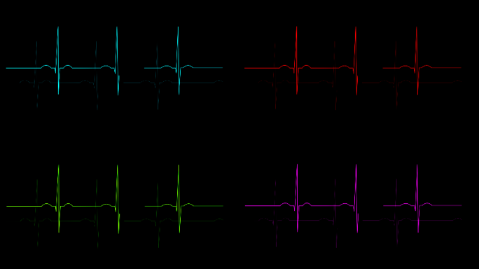 4K心电图心动心率心跳图-alpha通道
