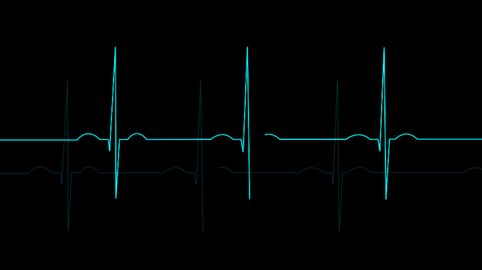 4K心电图心动心率心跳图-alpha通道