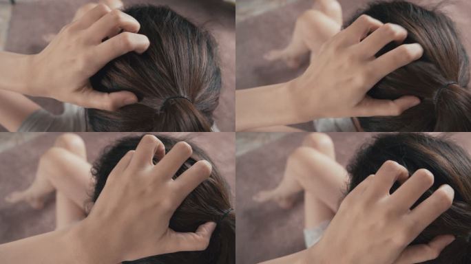 4k分辨率的亚洲女人发痒、抓挠头皮，头上的头发受损。美发概念