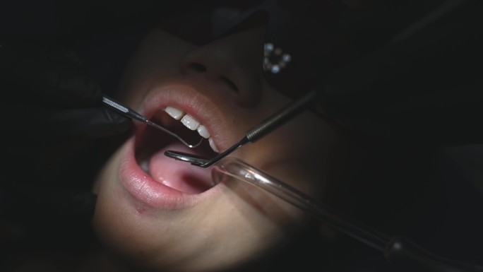 中国少女张嘴的牙科检查