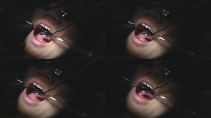 中国少女张嘴的牙科检查