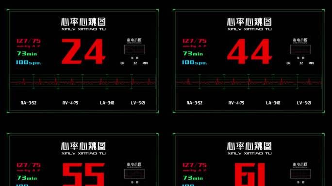 4K120帧科技医疗心率心跳图透明素材