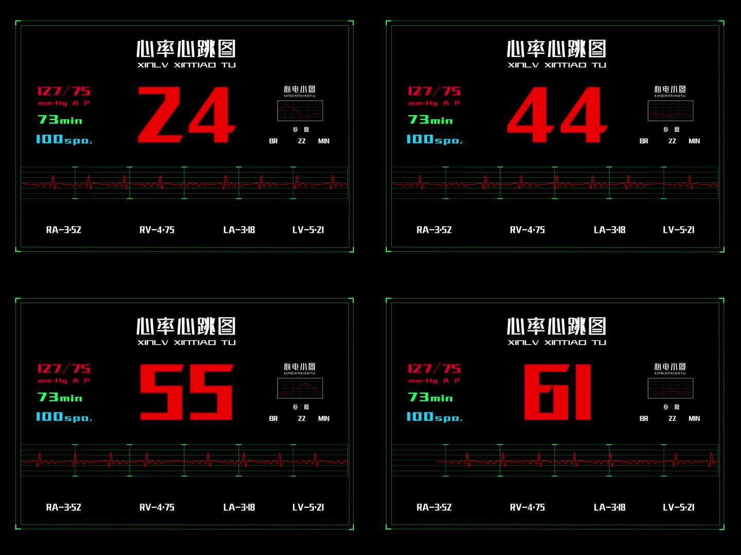 4K120帧科技医疗心率心跳图透明素材