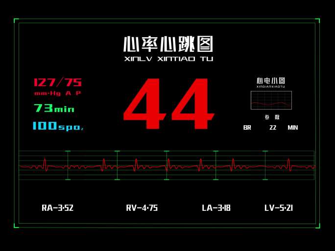 4K120帧科技医疗心率心跳图AE文件