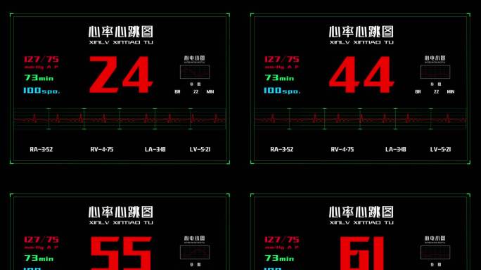 4K120帧科技医疗心率心跳图AE文件