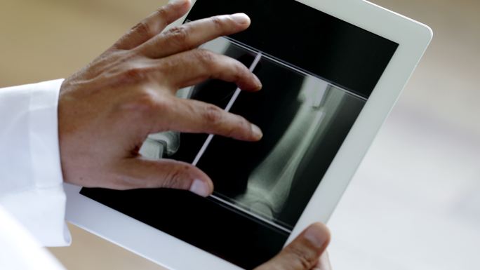 医生使用数字平板电脑进行骨折X光检查