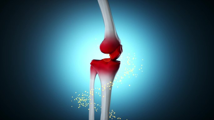 膝盖骨吸收粒子修复损伤3D动画