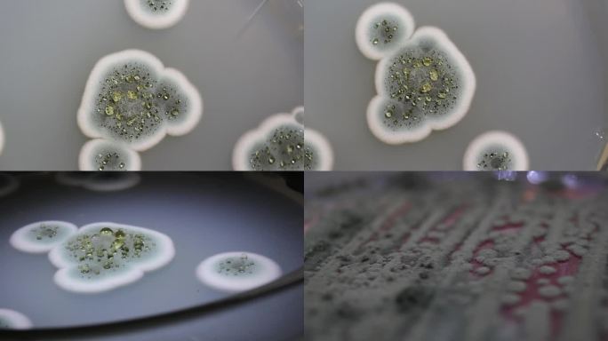 微生物学培养皿霉菌培养皿