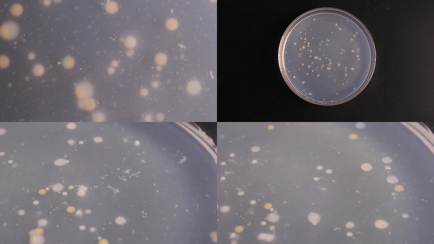 微生物学培养皿细菌PDA培养基基培养皿