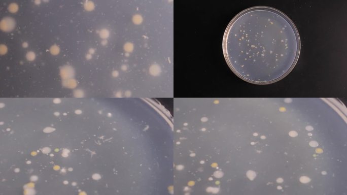 微生物学培养皿细菌PDA培养基基培养皿