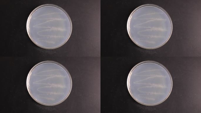 放线菌PDA培养基培养皿