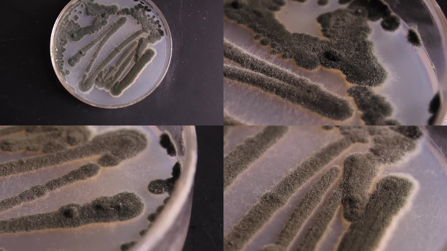 微生物学培养皿曲霉真菌PDA培养基培养皿