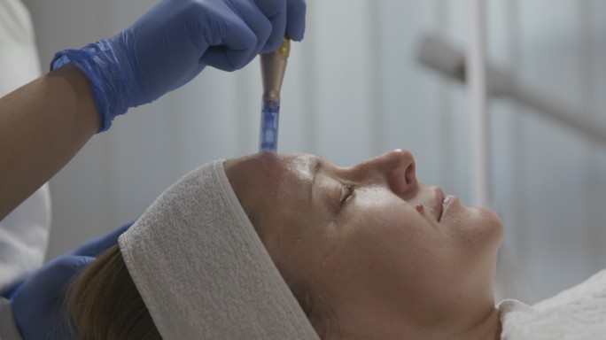 美容师在一名女性的脸上进行针剂治疗，特写