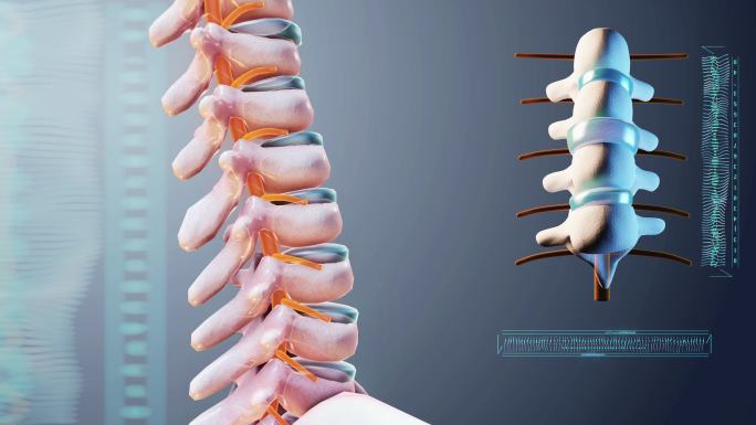 椎间盘突出影像治疗动画演示脊椎健康