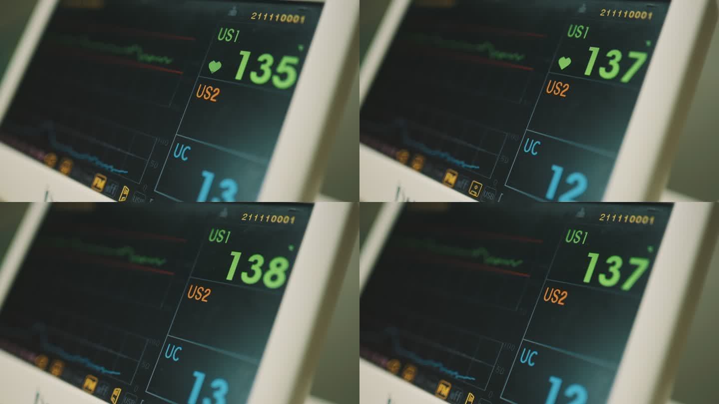 电脑监视器的特写，显示孕妇躺在病床上时疼痛的脉搏手势。