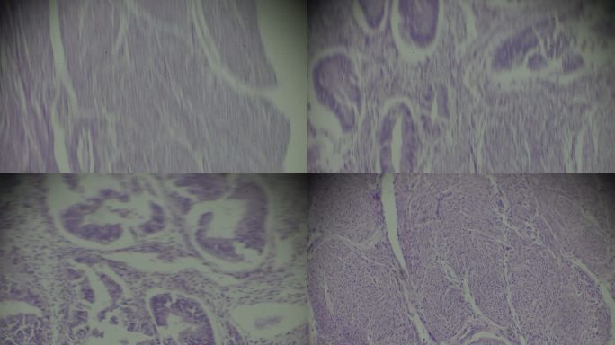 光学显微镜下不同区域的腺肌球蛋白活检