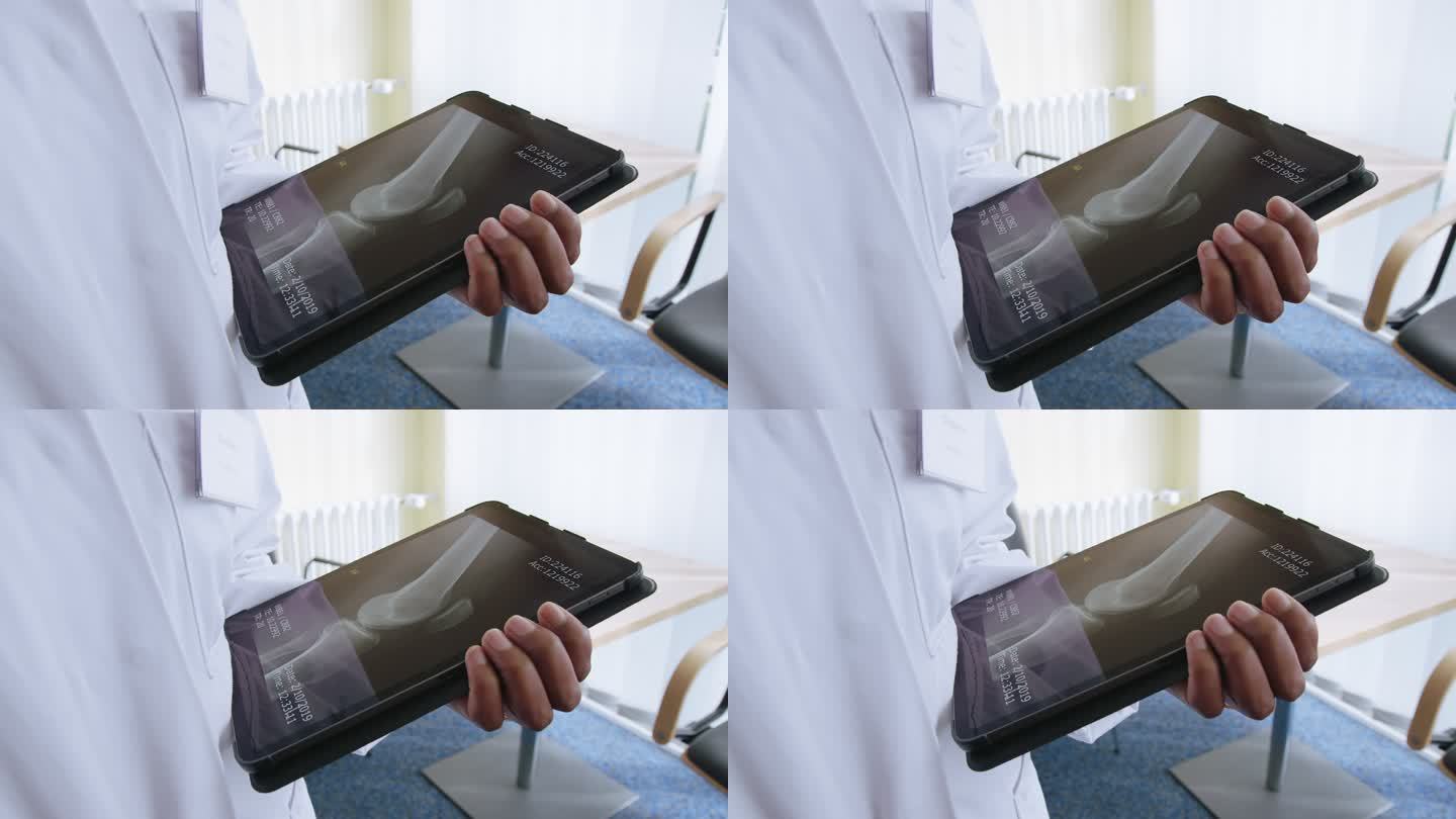 医生在数字平板电脑上检查四肢x光
