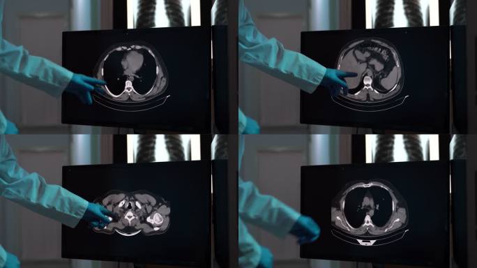 放射科医生在计算机监视器上检查X射线图像的视频