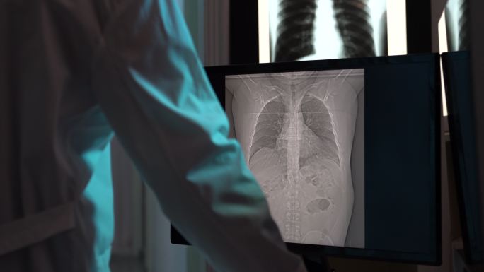 4K放射科医生在电脑监视器上检查CT扫描图像的视频
