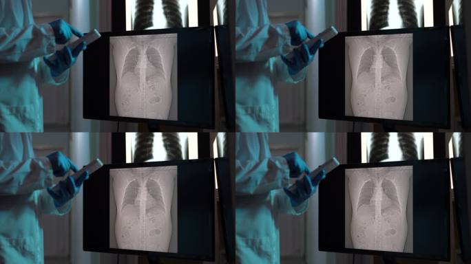 4K放射科医生在电脑监视器上检查CT扫描图像的视频