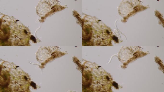 线虫-微生物浮游虫子