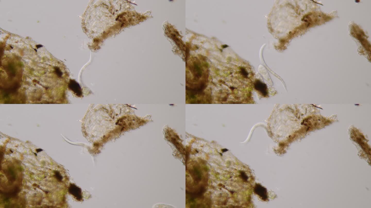线虫-微生物浮游虫子
