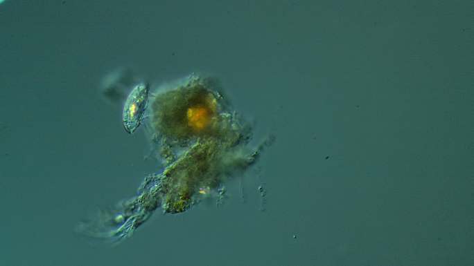 纤毛虫显微镜纤毛虫显微镜