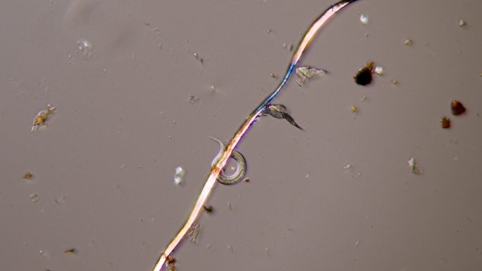 线虫-微生物水质检测微观