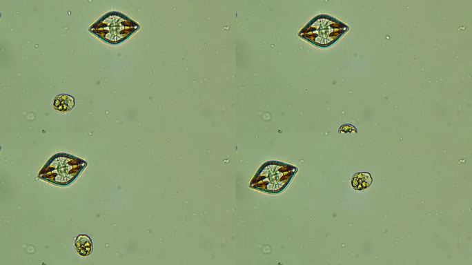 硅藻微生物显微镜新冠病毒细菌细胞微生物真