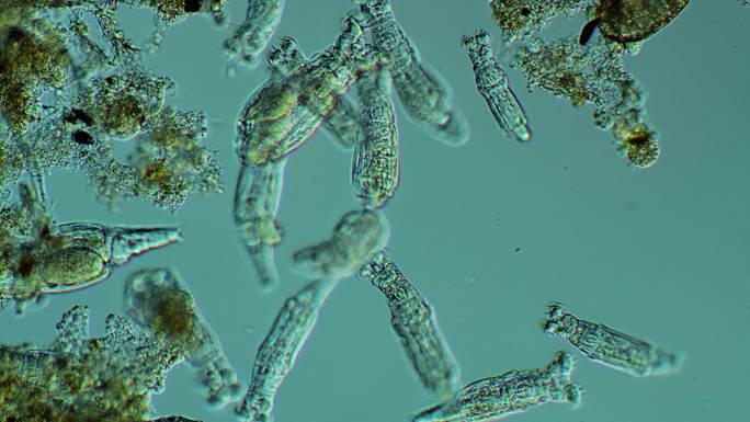 轮虫群落显微镜观察放大微生物轮虫群落