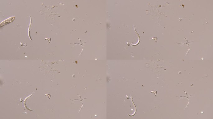 线虫-微生物传染源水质净化