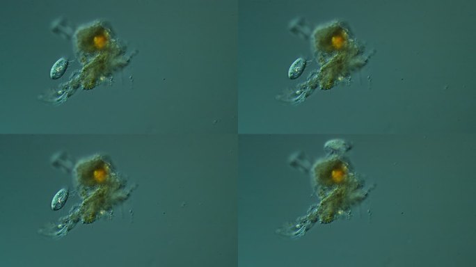 纤毛虫显微镜新冠病毒细菌细胞微生物真菌