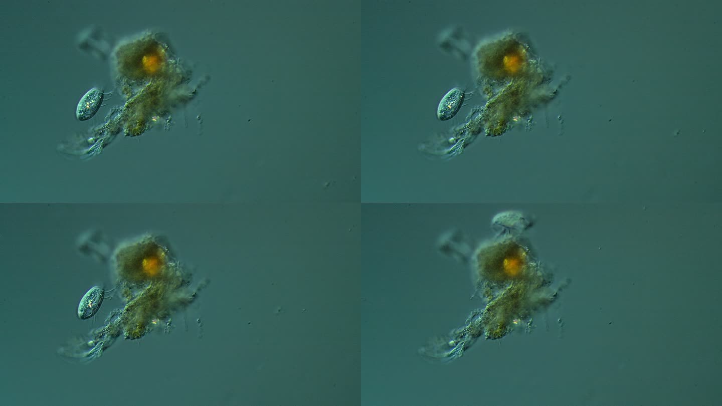 纤毛虫显微镜新冠病毒细菌细胞微生物真菌